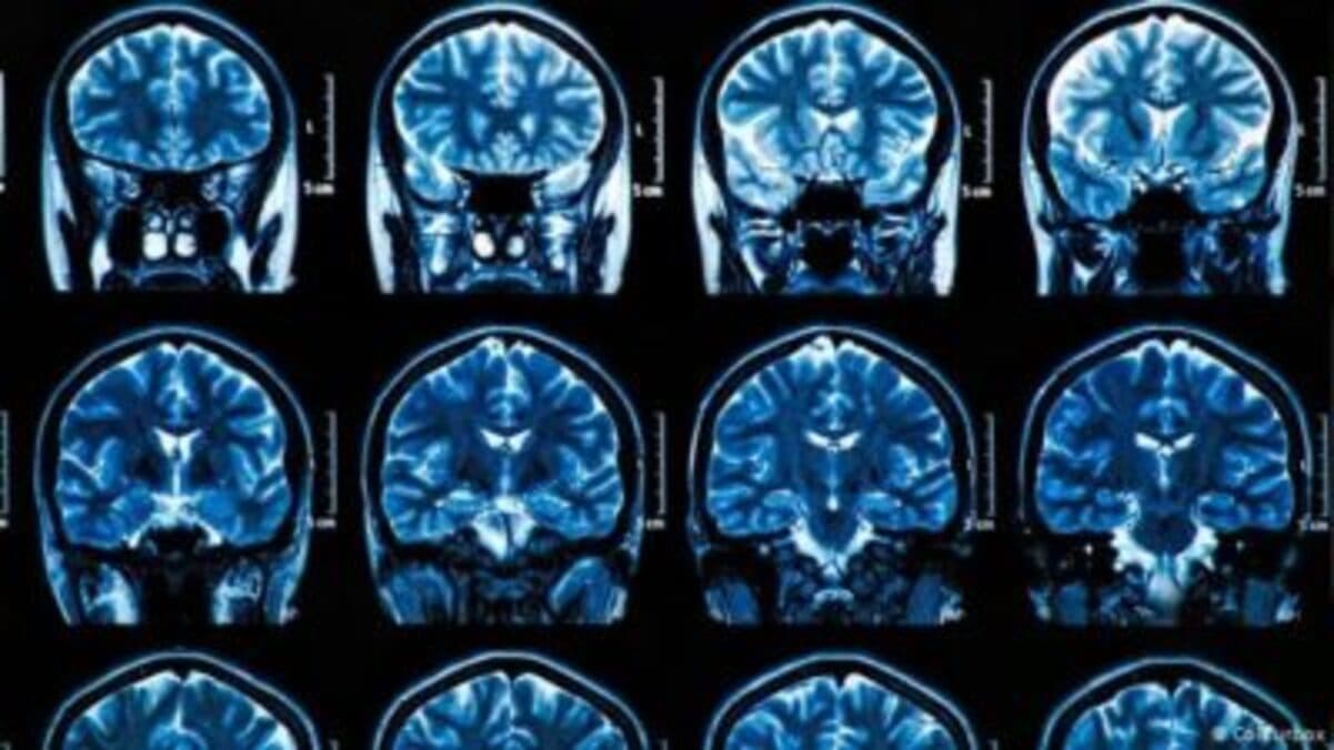 Logran que quimioterapia penetre en el cerebro para tratar tumor mortal