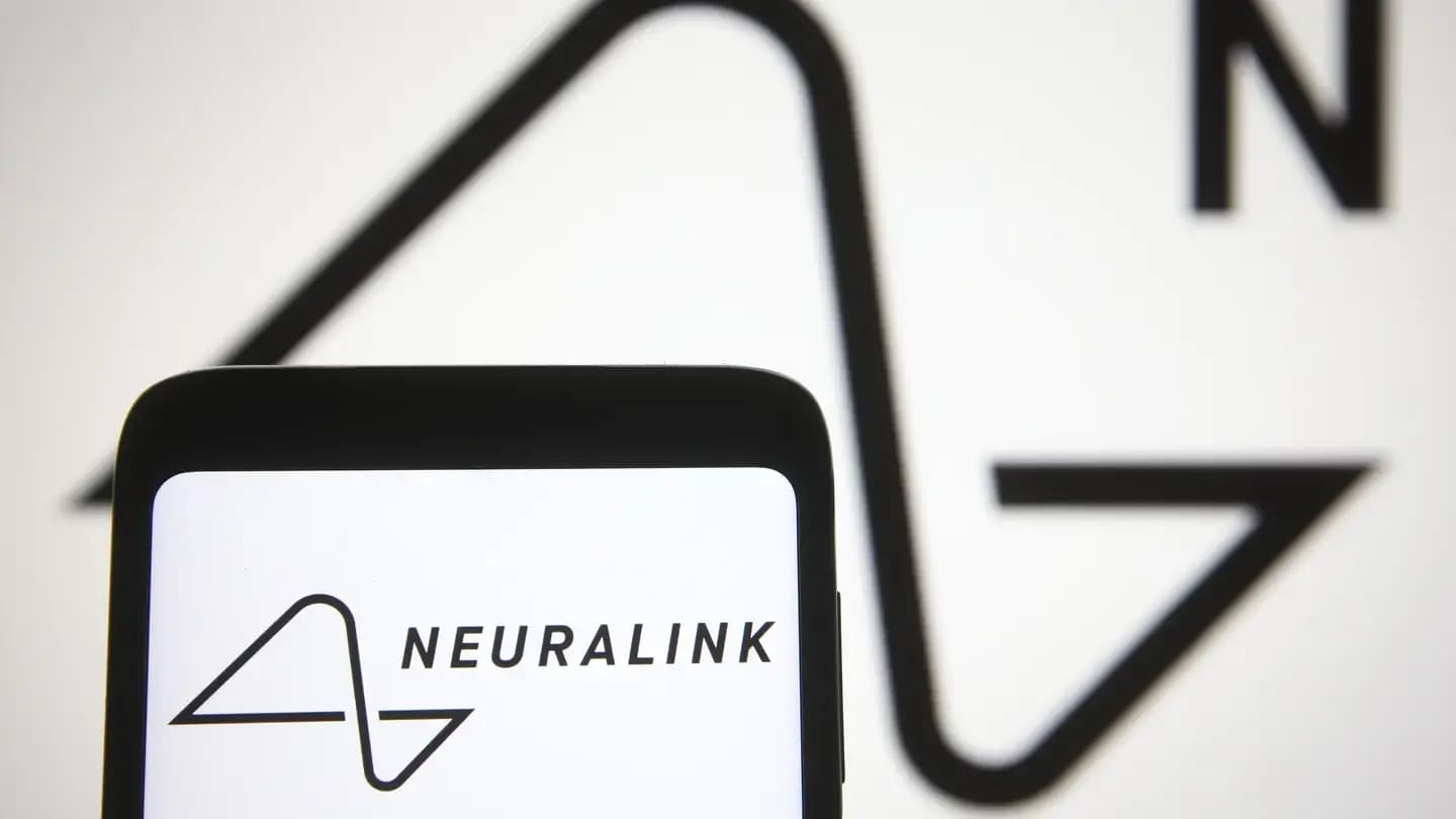Neuralink de Elon Musk busca voluntarios para probar su chip cerebral